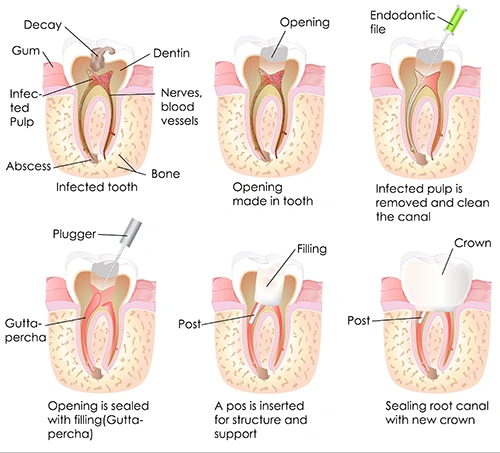 Dentist Mt. Laurel NJ