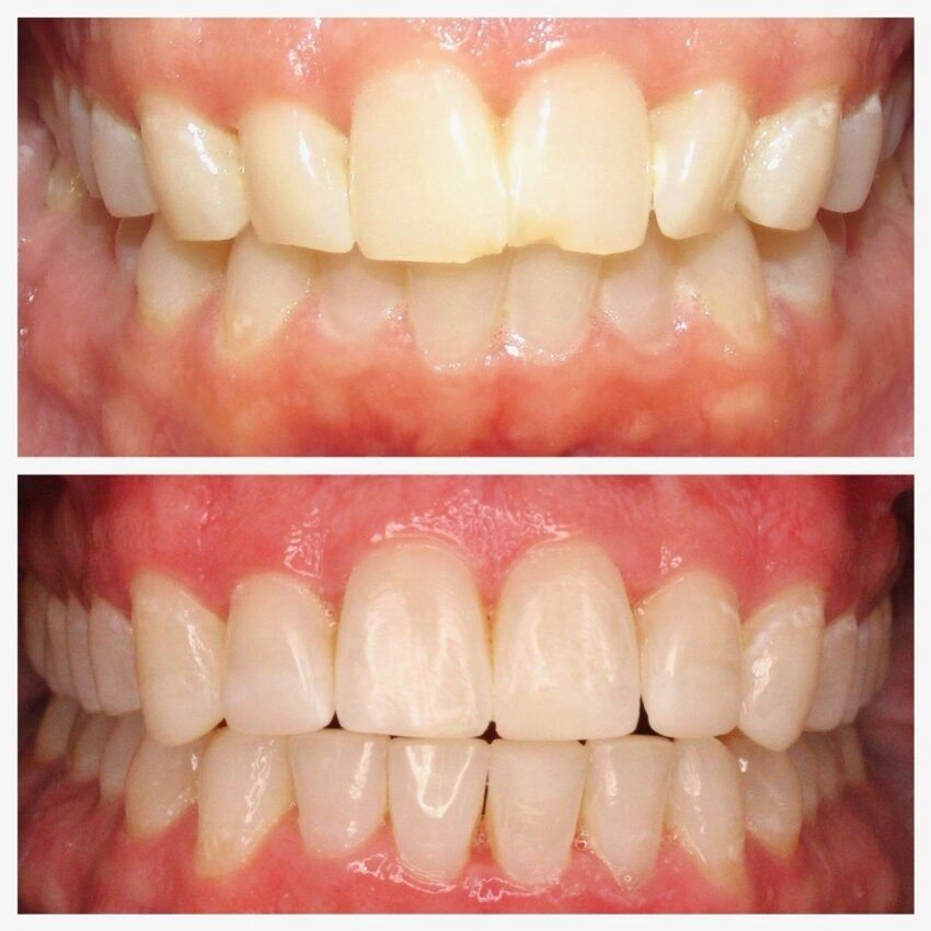 Dentist in Mt. Laurel