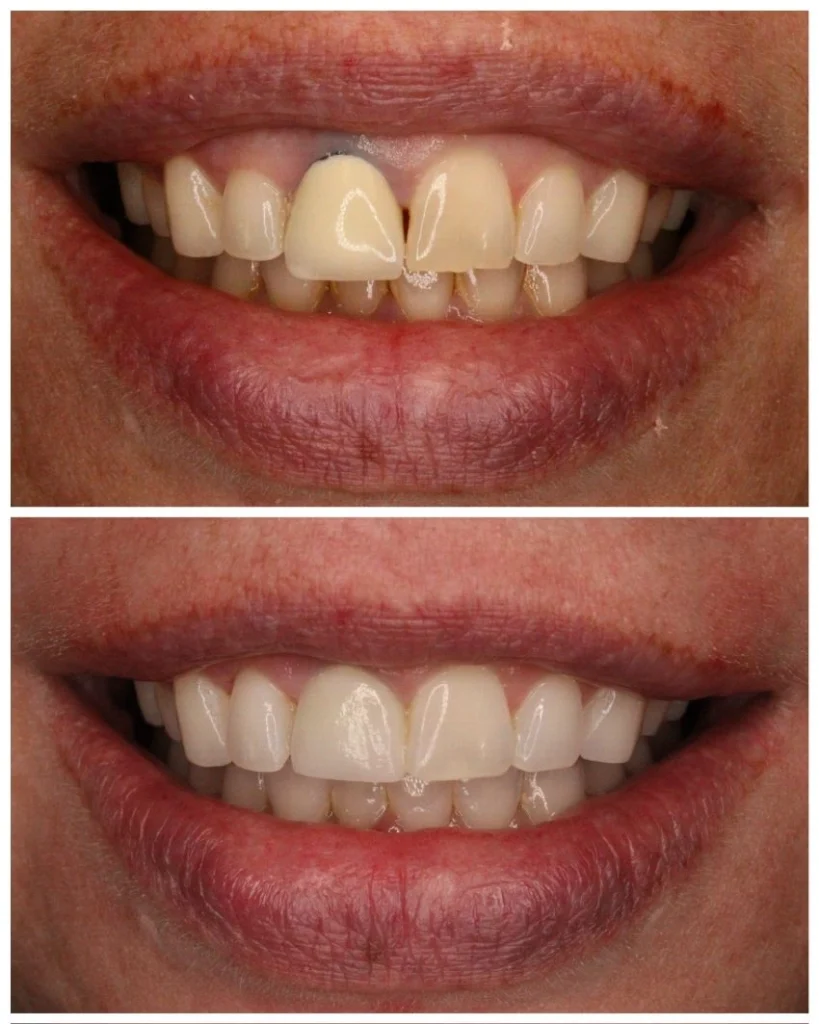 Dentist Mt. Laurel NJ