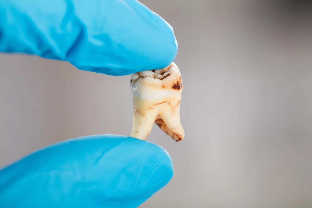 Mt. Laurel Dentist