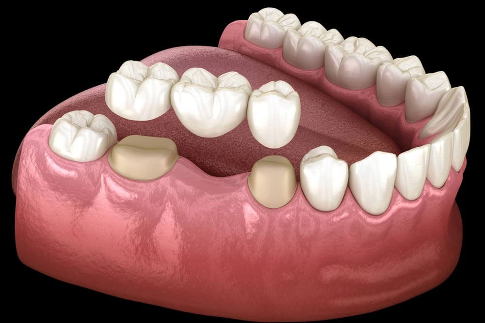 Dentist Mt. Laurel NJ