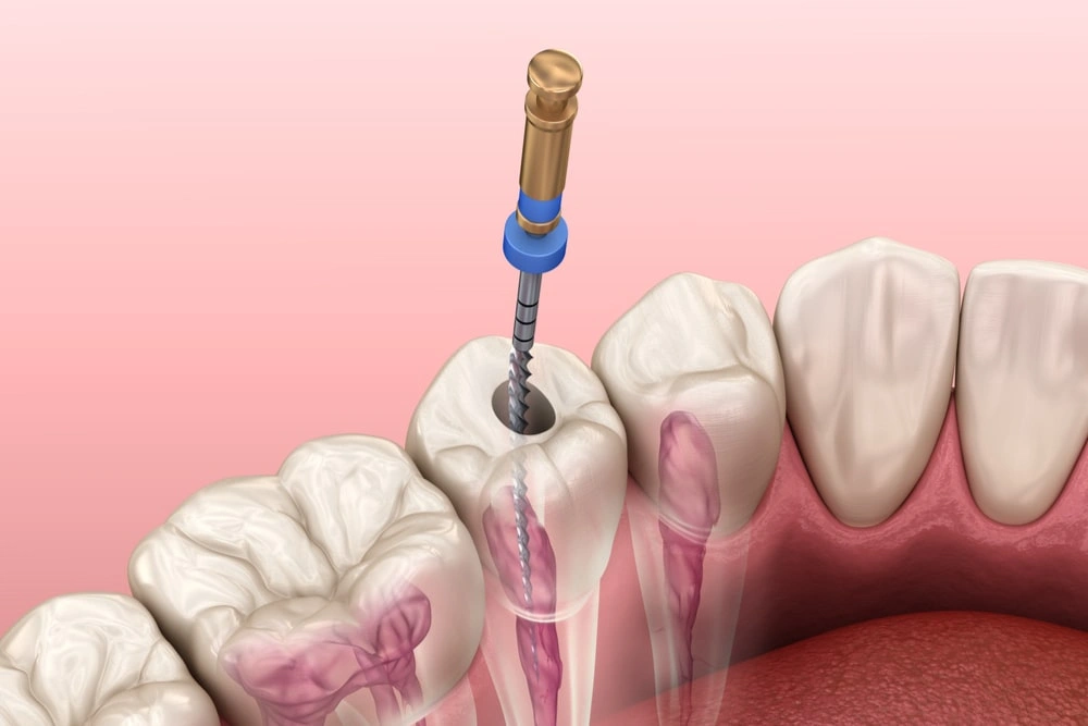 Dentist in Mt. Laurel NJ
