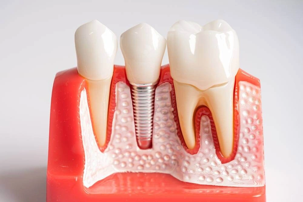 Dentist Near Me